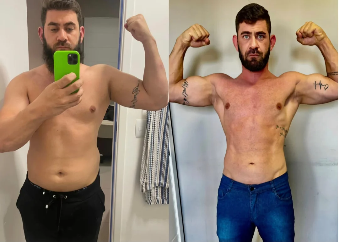 Qualidade de Vida - João - Antes e Depois